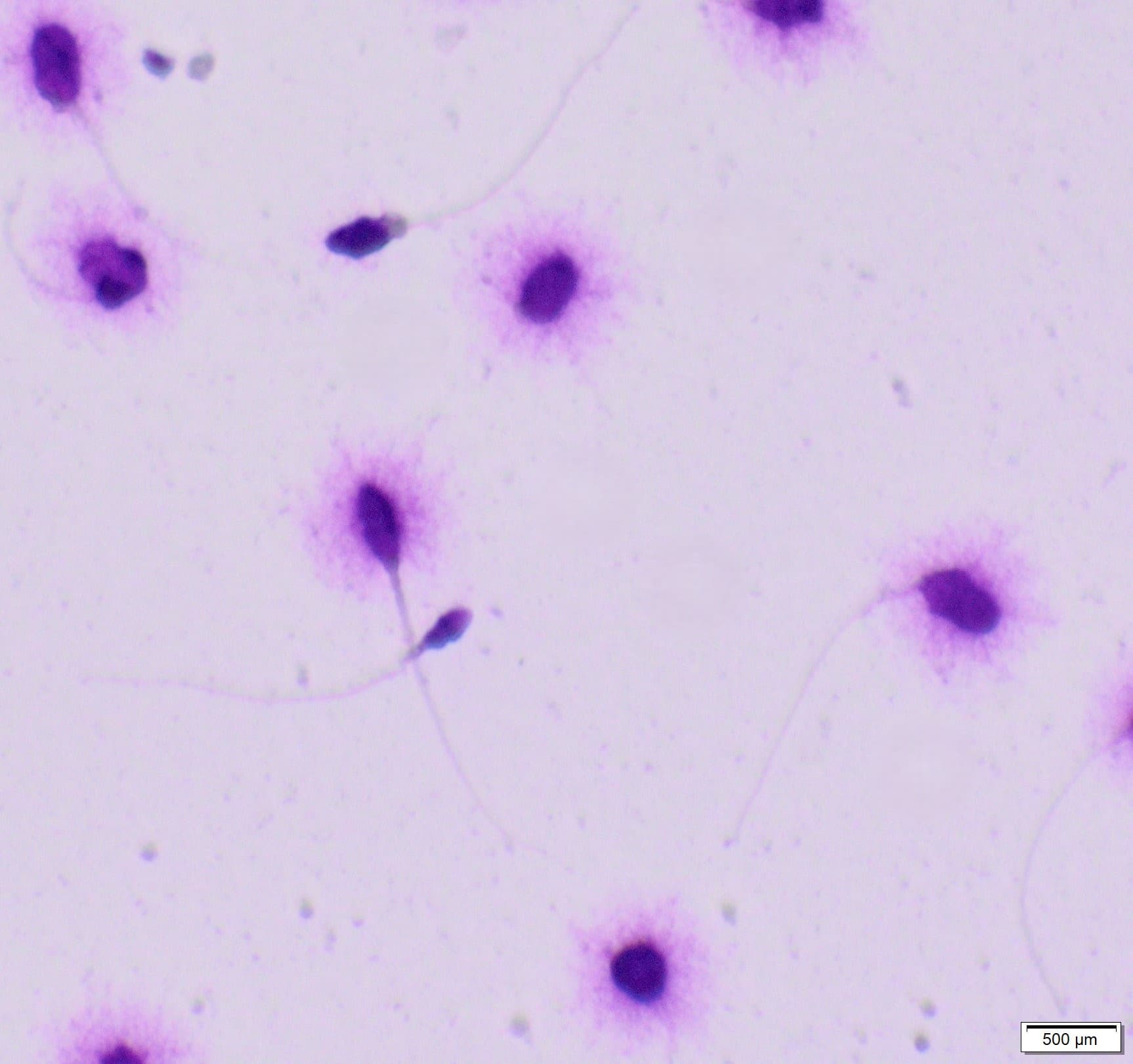 SCD-Test Mikroskopaufnahme - Spermien mit DNA-Halo